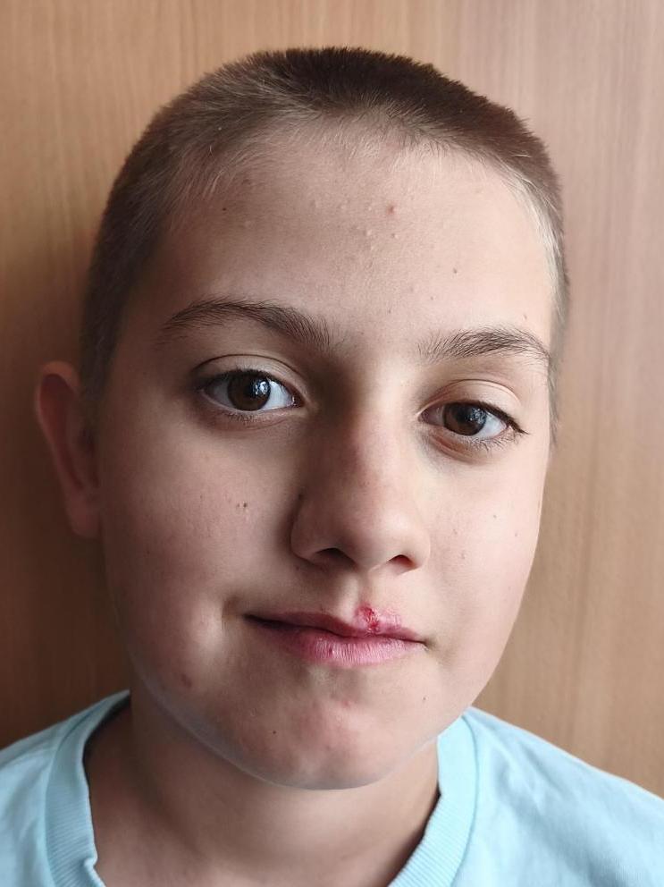 Matej Kőver