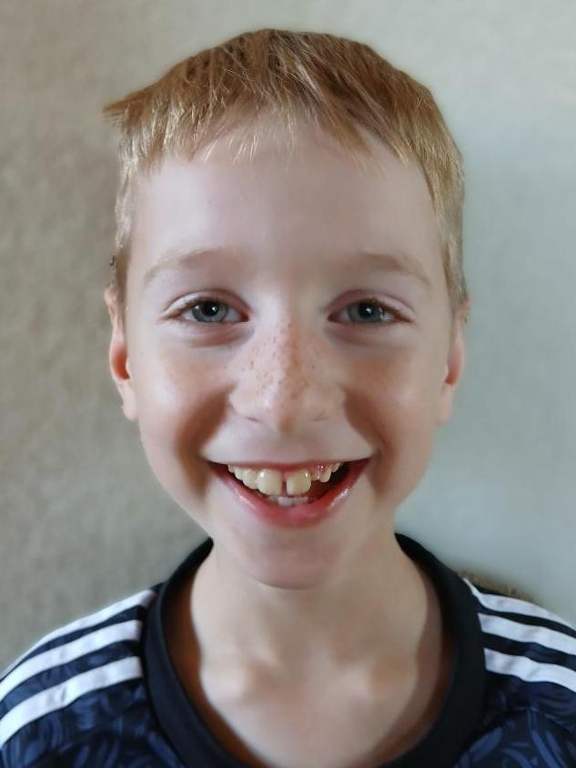 Šimon Kupčo